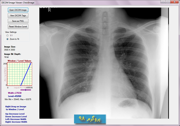 سورس پروژه ی DICOM Image Viewer (مشاهده تصاویر پزشکی) در c#